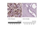 Immunohistochemistry analysis in human placenta and prostate tissues using HPA029698 antibody. Corresponding CGA RNA-seq data are presented for the same tissues.