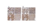 Immunohistochemistry analysis in human kidney and pancreas tissues using HPA029701 antibody. Corresponding APEH RNA-seq data are presented for the same tissues.