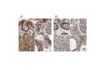 Immunohistochemical staining of human colon, kidney, liver and testis using Anti-RAD23B antibody HPA029718 (A) shows similar protein distribution across tissues to independent antibody HPA029720 (B).