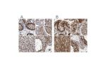 Immunohistochemical staining of human colon, kidney, liver and testis using Anti-RAD23B antibody HPA029720 (A) shows similar protein distribution across tissues to independent antibody HPA029718 (B).