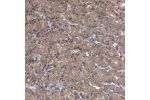 Immunohistochemical staining of human stomach shows moderate membranous positivity in glandular cells.