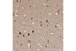 Immunohistochemical staining of human cerebral cortex shows strong cytoplasmic positivity in neuronal cells.