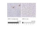 Immunohistochemistry analysis in human cerebral cortex and liver tissues using HPA029766 antibody. Corresponding GPR17 RNA-seq data are presented for the same tissues.