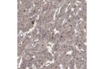 Immunohistochemical staining of human parathyroid gland shows cytoplasmic positivity in glandular cells.