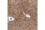 Immunohistochemical staining of human liver shows moderate cytoplasmic and membrane positivity in hepatocytes.