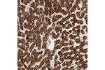 Immunohistochemical staining of human liver shows strong cytoplasmic positivity in hepatocytes.