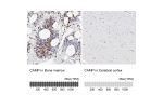 Immunohistochemistry analysis in human bone marrow and cerebral cortex tissues using HPA029874 antibody. Corresponding CAMP RNA-seq data are presented for the same tissues.