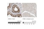 Immunohistochemistry analysis in human testis and skeletal muscle tissues using HPA029878 antibody. Corresponding KPNB1 RNA-seq data are presented for the same tissues.