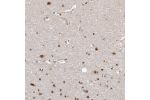 Immunohistochemical staining of human cerebral cortex shows moderate nuclear positivity in neurons and glial cells.