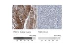 Immunohistochemistry analysis in human skeletal muscle and liver tissues using HPA029906 antibody. Corresponding PLEC RNA-seq data are presented for the same tissues.