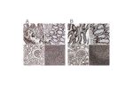 Immunohistochemical staining of human fallopian tube, gastrointestinal, kidney and lymphoid tissues using Anti-NUMA1 antibody HPA029912 (A) shows similar protein distribution across tissues to independent antibody HPA019841 (B).