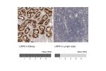 Immunohistochemistry analysis in human kidney and lymph node tissues using HPA029925 antibody. Corresponding LRP6 RNA-seq data are presented for the same tissues.