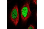 Immunofluorescent staining of human cell line U-2 OS shows localization to nucleoplasm.
