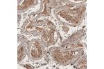 Immunohistochemical staining of human testis shows moderate to strong nuclear positivity in squamous epithelial cells.