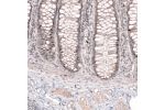 Immunohistochemical staining of human rectum shows moderate nuclear positivity in a subset of glandular cells.