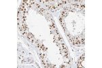 Immunohistochemical staining of human testis shows strong nuclear positivity in cells in seminiferous ducts.