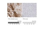 Immunohistochemistry analysis in human skeletal muscle and liver tissues using Anti-TTN antibody. Corresponding TTN RNA-seq data are presented for the same tissues.