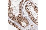 Immunohistochemical staining of human testis shows strong nuclear and cytoplasmic positivity in cells of seminiferus ducts.