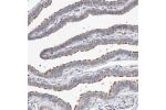Immunohistochemical staining of human fallopian tube shows strong positivity in ciliated cells.