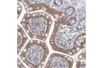 Immunohistochemical staining of human small intestine shows moderate cytoplasmic positivity in glandular cells.