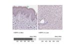 Immunohistochemistry analysis in human skin and liver tissues using HPA030180 antibody. Corresponding HOPX RNA-seq data are presented for the same tissues.
