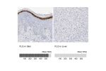 Immunohistochemistry analysis in human skin and liver tissues using HPA030188 antibody. Corresponding FLG RNA-seq data are presented for the same tissues.