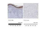 Immunohistochemistry analysis in human skin and liver tissues using HPA030189 antibody. Corresponding FLG RNA-seq data are presented for the same tissues.
