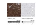 Immunohistochemistry analysis in human tonsil and skeletal muscle tissues using HPA030225 antibody. Corresponding PSMB10 RNA-seq data are presented for the same tissues.