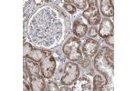 Immunohistochemical staining of human kidney shows strong granular cytoplasmic positivity in cells in tubules.