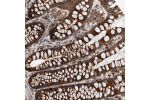 Immunohistochemical staining of human colon shows strong cytoplasmic positivity in glandular cells.