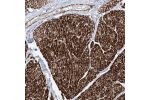 Immunohistochemical staining of human smooth muscle shows strong cytoplasmic positivity in smooth muscle cells.