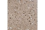 Immunohistochemical staining of human cerebral cortex shows moderate to strong nuclear and cytoplasmic positivity in neurons.