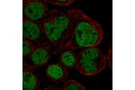 Immunofluorescent staining of human cell line HEL shows localization to nucleoplasm.