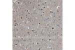 Immunohistochemical staining of human cerebral cortex shows strong nuclear positivity in glial cells.