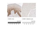 Immunohistochemistry analysis in human skin and skeletal muscle tissues using HPA030411 antibody. Corresponding CXADR RNA-seq data are presented for the same tissues.