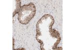 Immunohistochemical staining of human prostate shows strong membranous positivity in glandular cells.