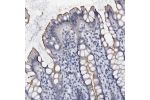 Immunohistochemical staining of human prostate shows distinct positivity in secretions from glandular cells.