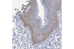Immunohistochemical staining of human skin shows weak to moderate cytoplasmic positivity in epidermal cells.