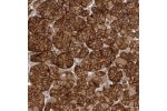 Immunohistochemical staining of human stomach shows strong cytoplasmic and membranous positivity in chief cells.