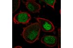 Immunofluorescent staining of human cell line PC-3 shows localization to nucleus.