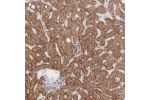 Immunohistochemical staining of human liver shows strong cytoplasmic positivity in hepatocytes.