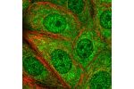 Immunofluorescent staining of human cell line MCF7 shows positivity in cytoplasm & nucleus but excluded from the nucleoli.