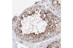 Immunohistochemical staining of human testis shows moderate granular cytoplasmic positivity in cells in seminiferous ducts.