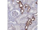 Immunohistochemical staining of human kidney shows strong cytoplasmic and membranous positivity in cells in tubules.