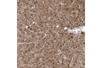 Immunohistochemical staining of human liver shows moderate nuclear and cytoplasmic positivity in hepatocytes.