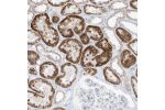 Immunohistochemical staining of human kidney shows moderate cytoplasmic positivity in cells in tubules.