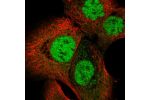 Immunofluorescent staining of human cell line A-431 shows localization to nucleoplasm.