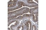 Immunohistochemical staining of human fallopian tube shows moderate granular cytoplasmic positivity in glandular cells.