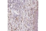 Immunohistochemical staining of human urinary bladder shows distinct positivity positivity in connective tissue.