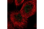 Immunofluorescent staining of human cell line A-431 shows localization to nucleoplasm.